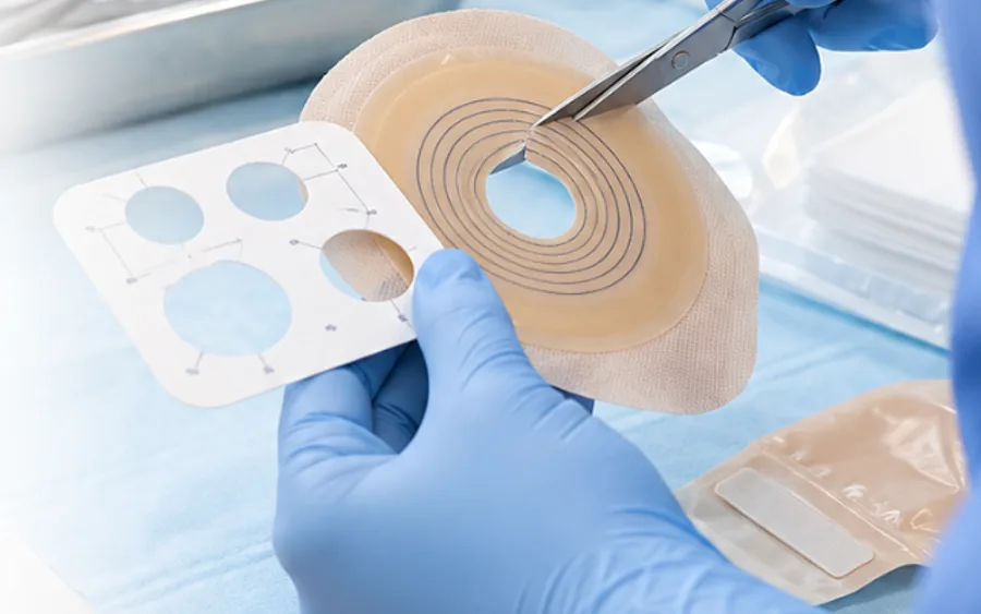 Manejo Clínico Avanzado de Heridas y Ostomías